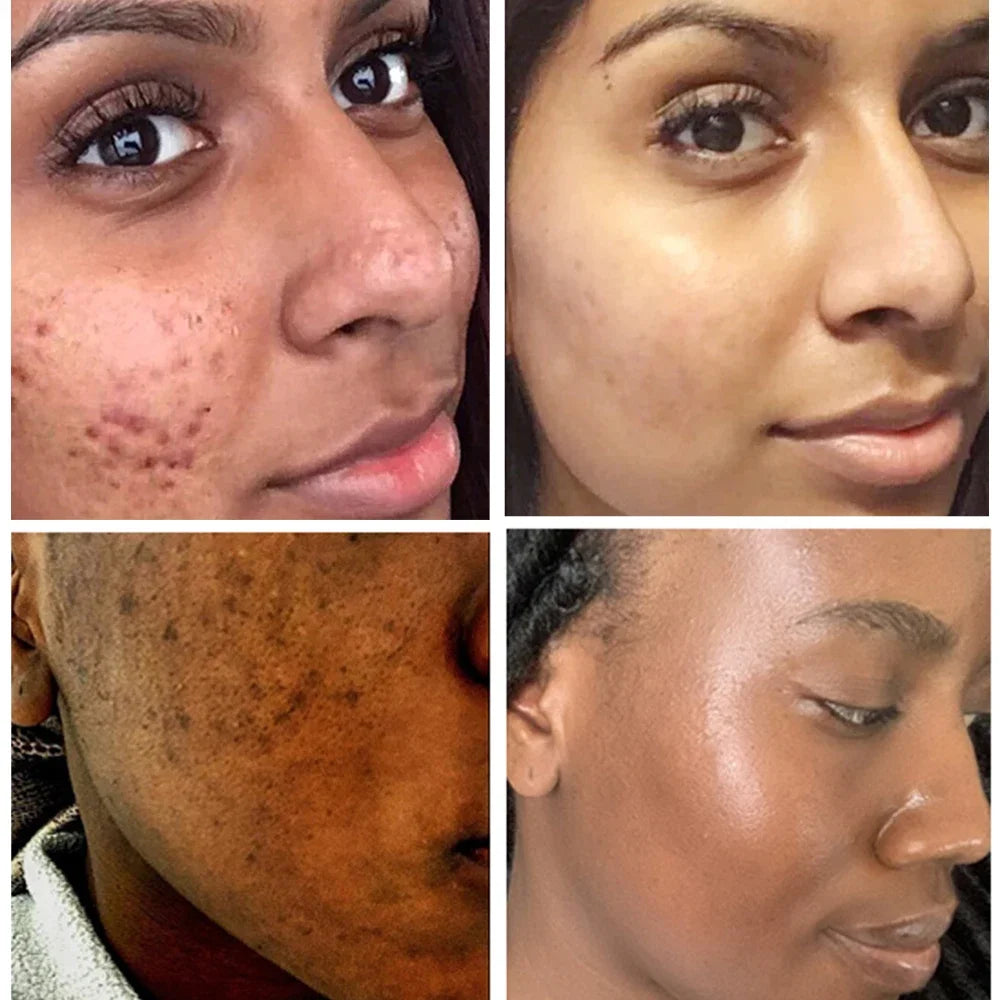 S1c79c7ee7148470d9ef0cc45a30028a2m